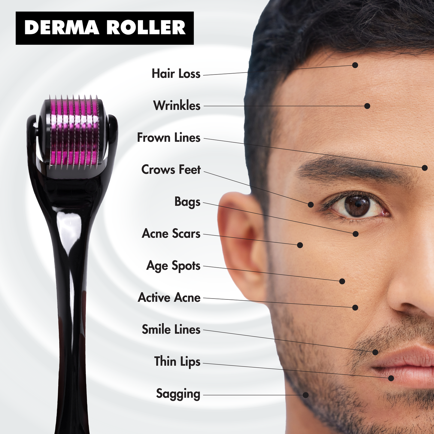 Manliness dermaroller system 540 needles 0.50 mm