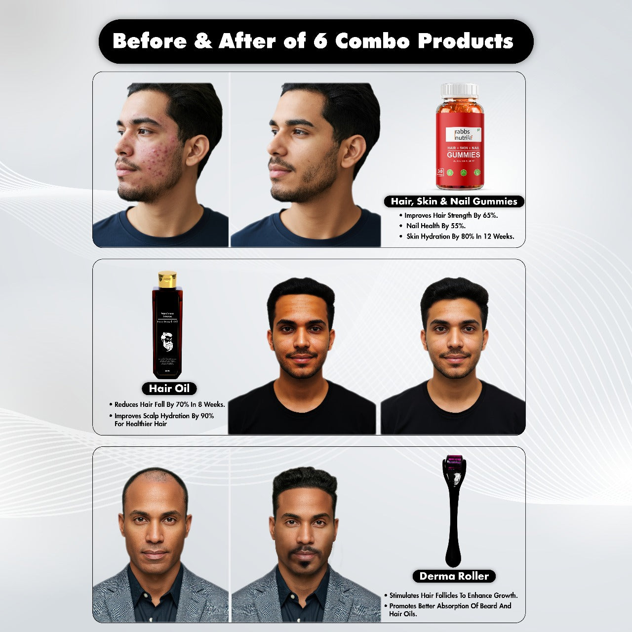 8. COMBO MANLINESS HAIR OIL*DERMAROLLER #*RABBS NUTRI HAIR SKIN AND NAILS GUMMIES COMBO(Pack of 3)