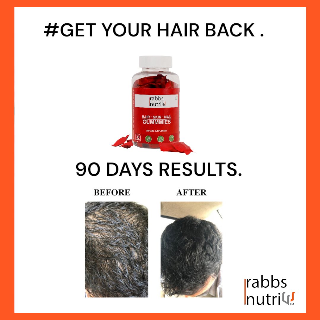 Hair, Skin and Nail Gummies