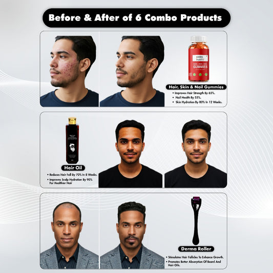8. COMBO MANLINESS HAIR OIL*DERMAROLLER #*RABBS NUTRI HAIR SKIN AND NAILS GUMMIES COMBO(Pack of 3)